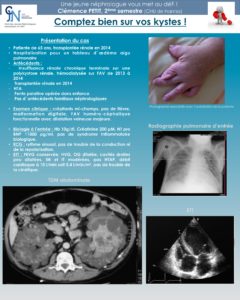 Cas n° 3 : Comptez bien sur vos kystes !